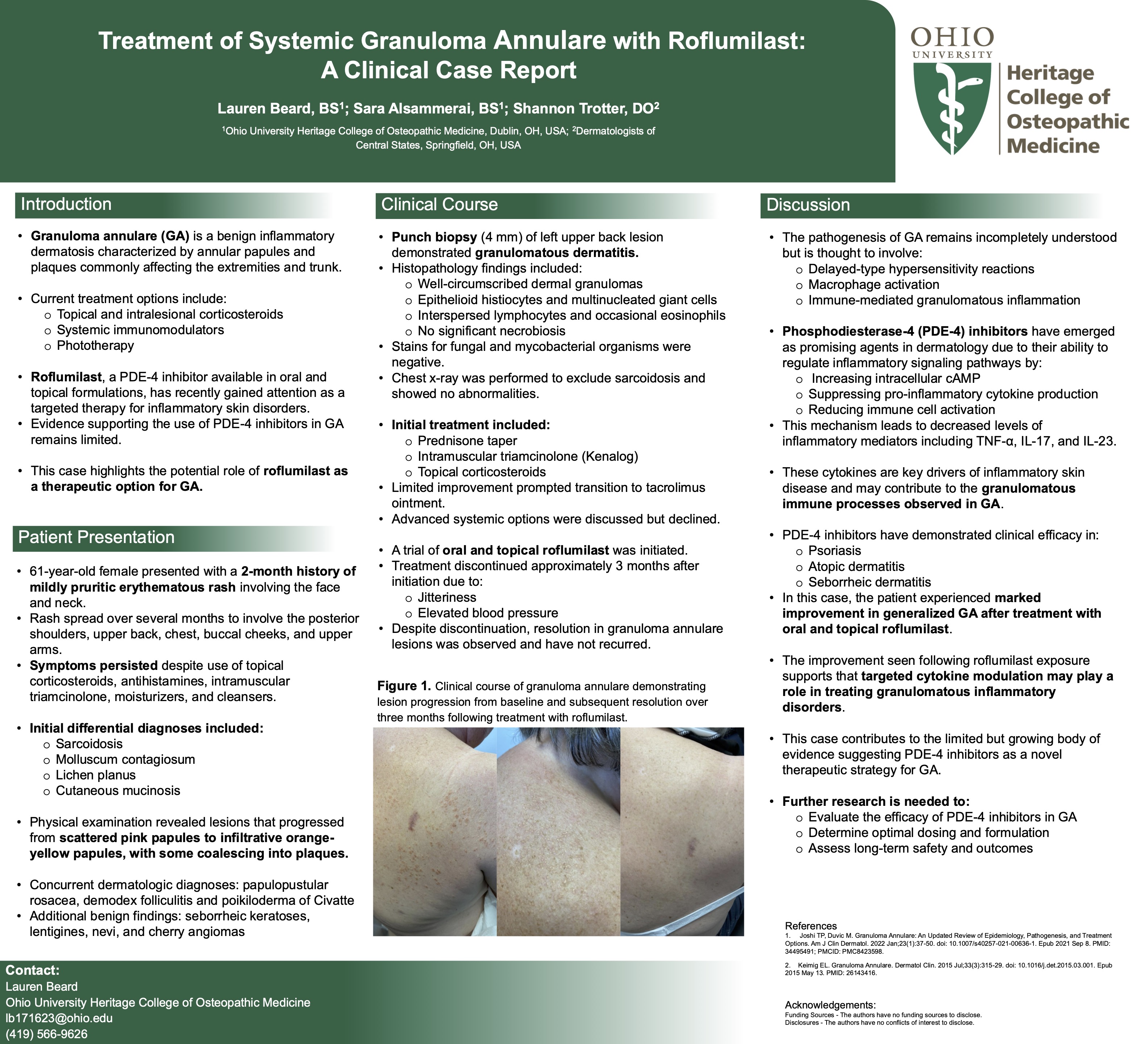 Medical Dermatology Society - MDS - Treatment of Systemic Granuloma ...